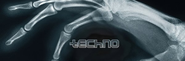 RTG, Techno, Muzyka